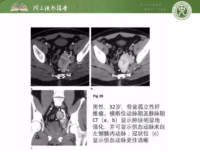 【PPT】骨骼肌肉系统肿块影像学成像基本概念