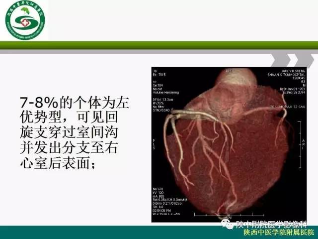 【PPT】冠状动脉、静脉正常解剖与变异