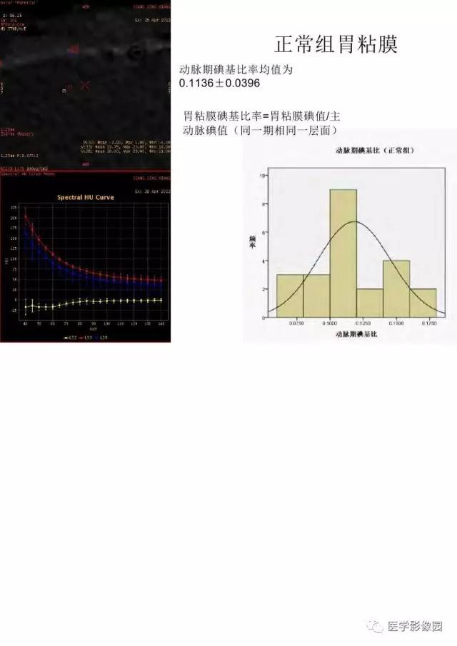 【PPT】胃肿瘤影像检查和诊断思路