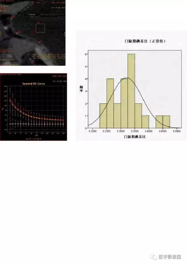 【PPT】胃肿瘤影像检查和诊断思路