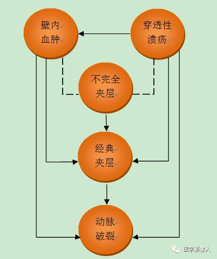 主动脉壁内血肿影像学新概念(附结构式报告模板) 主动脉壁内血肿影像学新概念(附结构式报告模板)