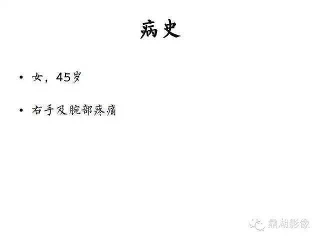 【病例】软骨钙盐沉着症1例X线影像表现