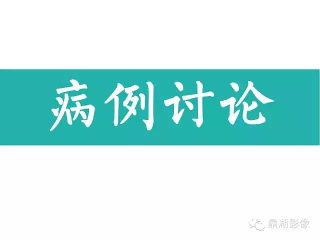 【病例】软骨钙盐沉着症1例X线影像表现