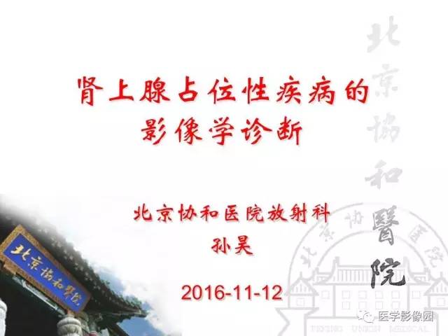 【PPT】肾上腺占位性疾病的影像学诊断