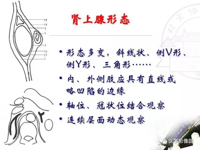 【PPT】肾上腺占位性疾病的影像学诊断