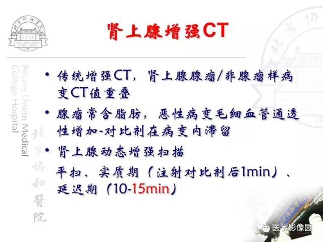 【PPT】肾上腺占位性疾病的影像学诊断