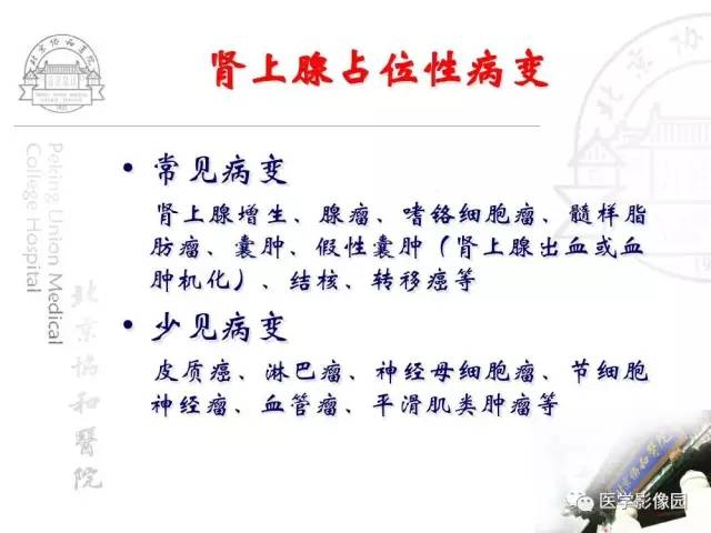 【PPT】肾上腺占位性疾病的影像学诊断