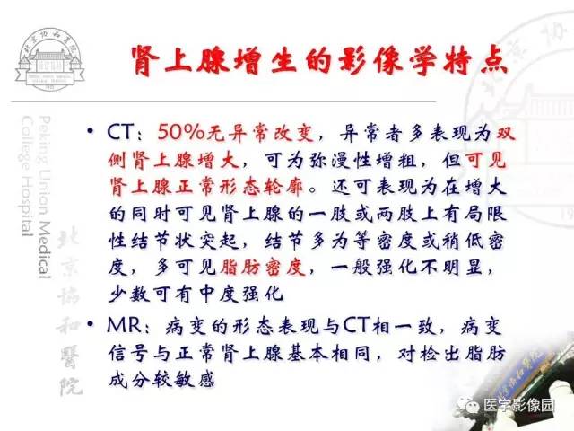 【PPT】肾上腺占位性疾病的影像学诊断