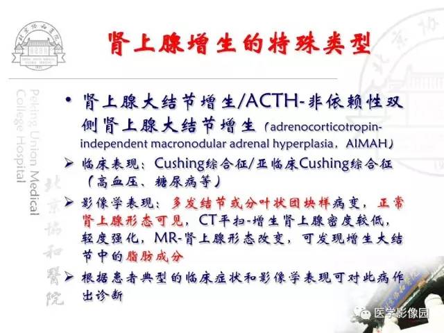 【PPT】肾上腺占位性疾病的影像学诊断
