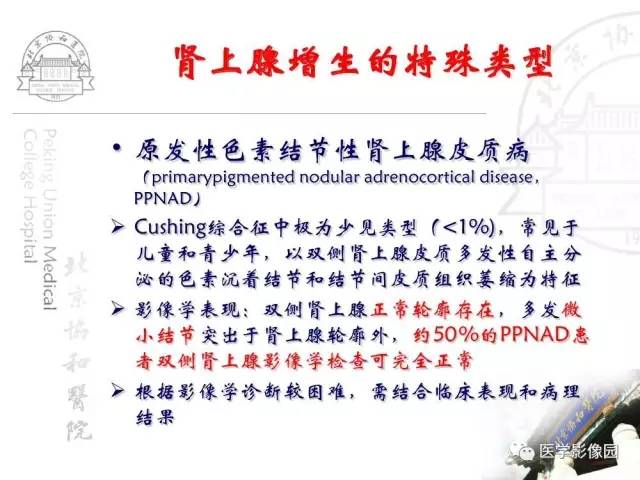 【PPT】肾上腺占位性疾病的影像学诊断