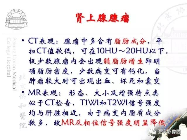 【PPT】肾上腺占位性疾病的影像学诊断