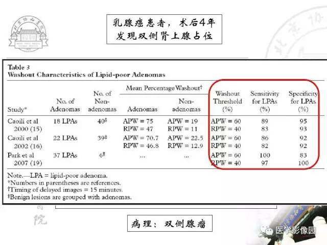 【PPT】肾上腺占位性疾病的影像学诊断