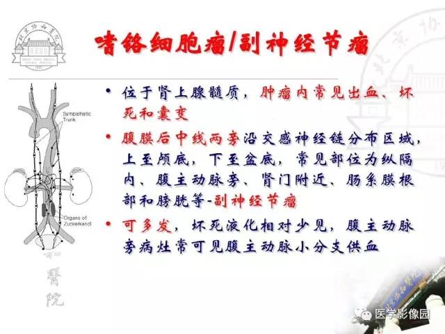 【PPT】肾上腺占位性疾病的影像学诊断