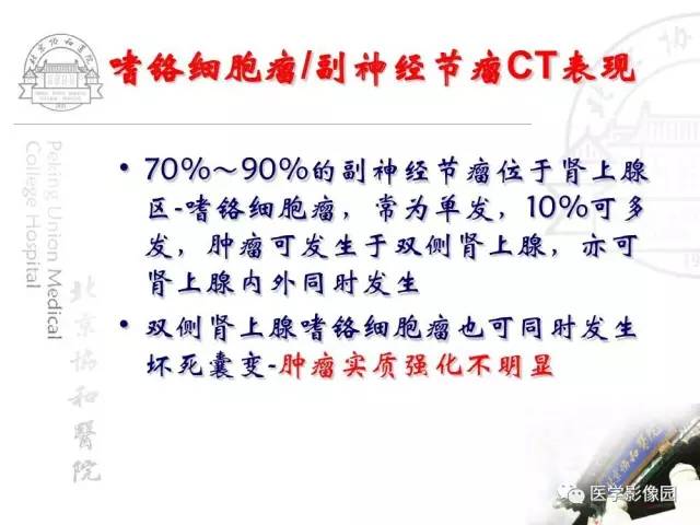 【PPT】肾上腺占位性疾病的影像学诊断