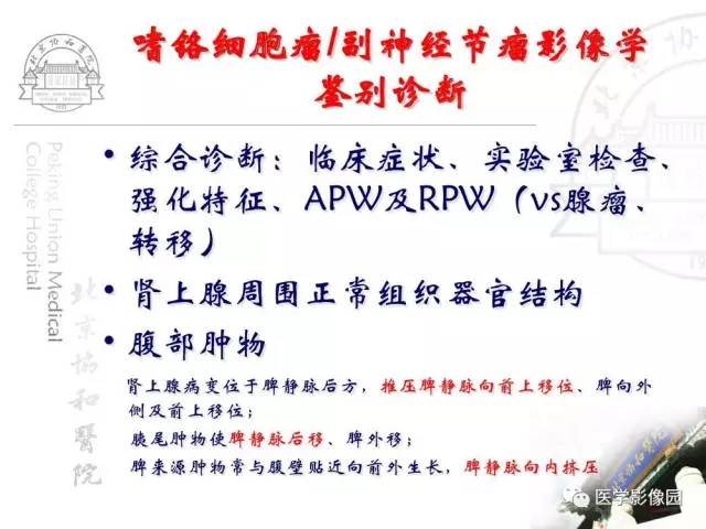 【PPT】肾上腺占位性疾病的影像学诊断