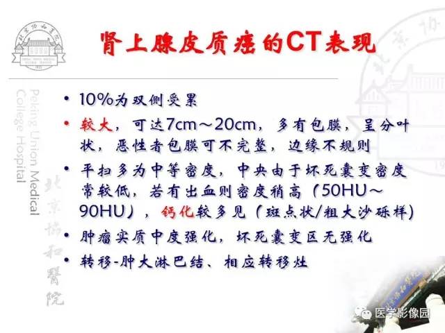【PPT】肾上腺占位性疾病的影像学诊断