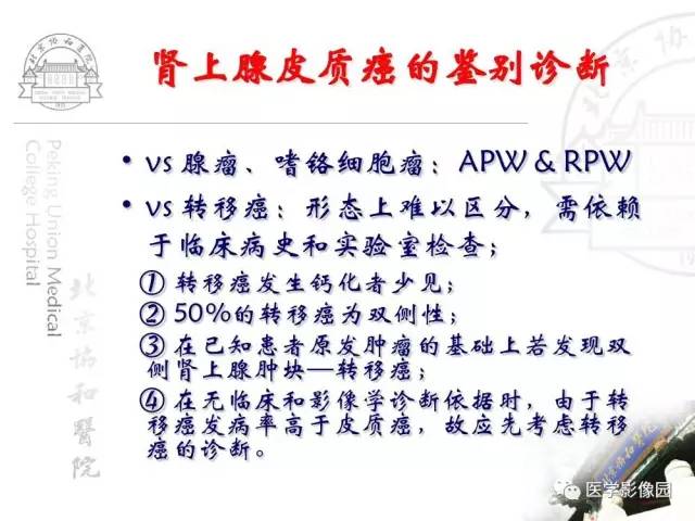 【PPT】肾上腺占位性疾病的影像学诊断