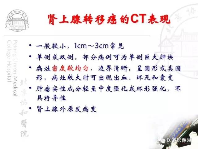 【PPT】肾上腺占位性疾病的影像学诊断
