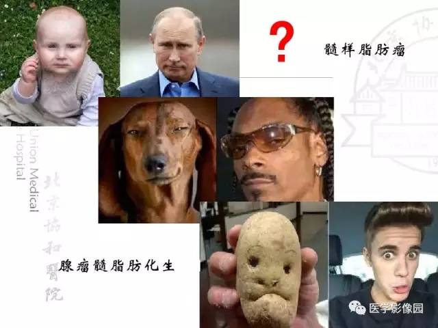 【PPT】肾上腺占位性疾病的影像学诊断