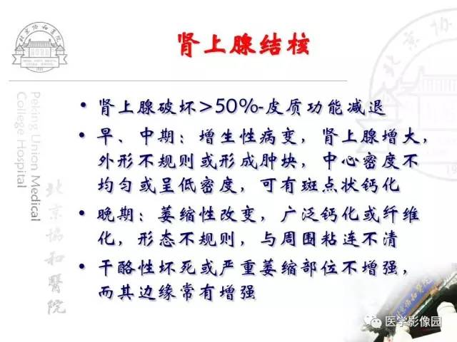 【PPT】肾上腺占位性疾病的影像学诊断