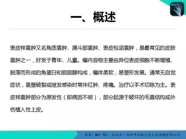 【病例】右侧颞上窝表皮样囊肿1例CT及MR
