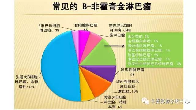 【病例】腹膜后恶性淋巴瘤1例CT影像表现
