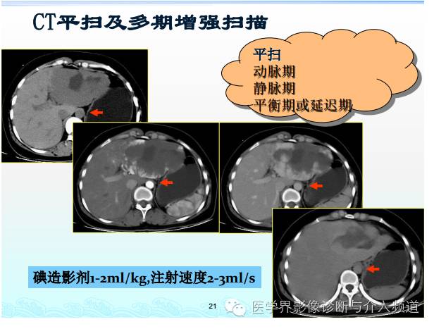 破谣言，破迷信，增强CT的5大问题不得不知！