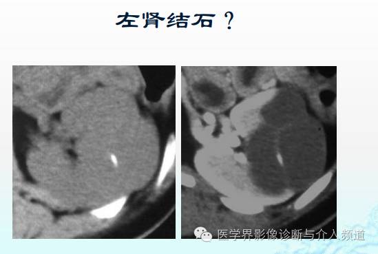 破谣言,破迷信,增强CT的5大问题不得不知! 破谣言,破迷信,增强CT的5大问题不得不知!