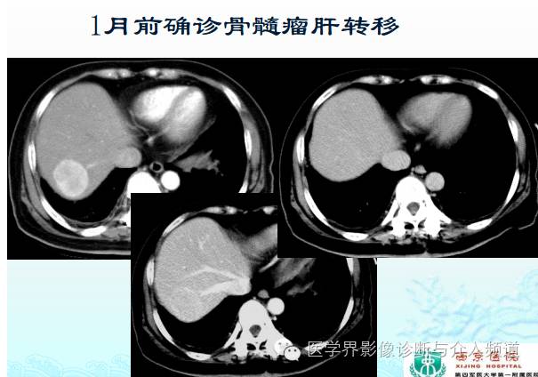 破谣言,破迷信,增强CT的5大问题不得不知! 破谣言,破迷信,增强CT的5大问题不得不知!