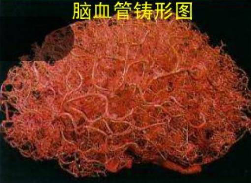 脑内微出血是什么? 脑内微出血是什么?