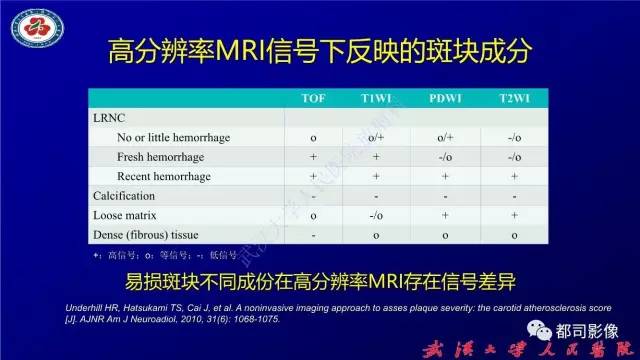 【PPT】高分辨率MRI在颈动脉粥样硬化斑块中的临床应用