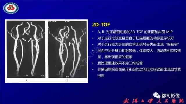 【PPT】高分辨率MRI在颈动脉粥样硬化斑块中的临床应用