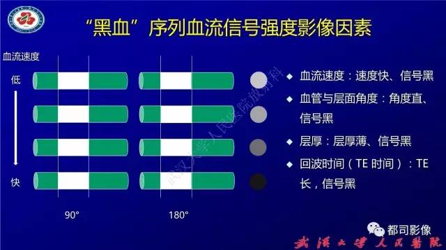 【PPT】高分辨率MRI在颈动脉粥样硬化斑块中的临床应用