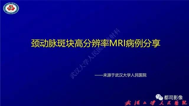 【PPT】高分辨率MRI在颈动脉粥样硬化斑块中的临床应用
