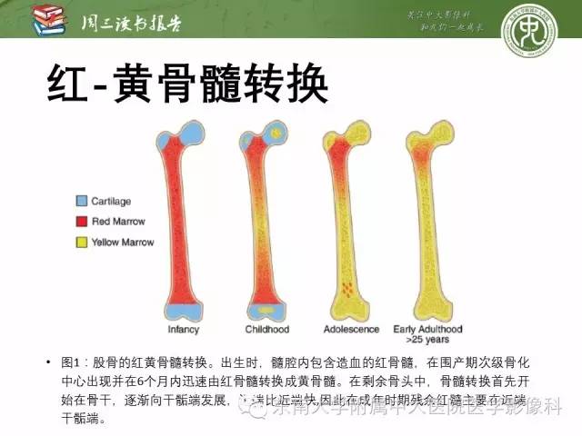 【PPT】儿童骨髓MRI表现