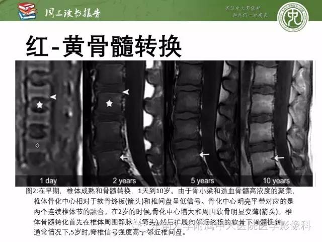 【PPT】儿童骨髓MRI表现