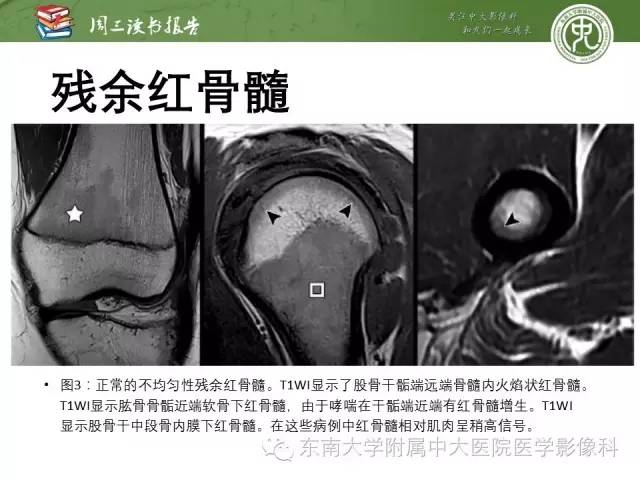 【PPT】儿童骨髓MRI表现