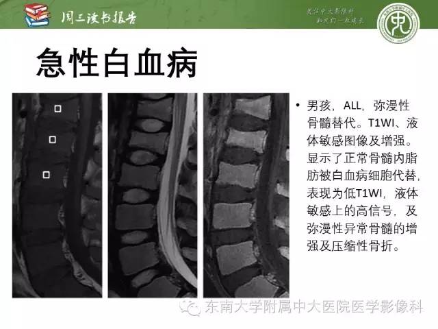 【PPT】儿童骨髓MRI表现