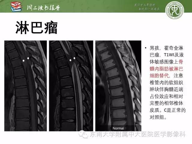 【PPT】儿童骨髓MRI表现
