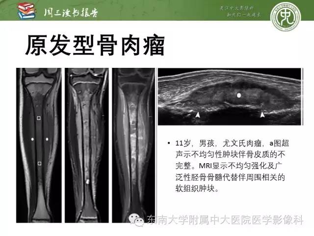 【PPT】儿童骨髓MRI表现