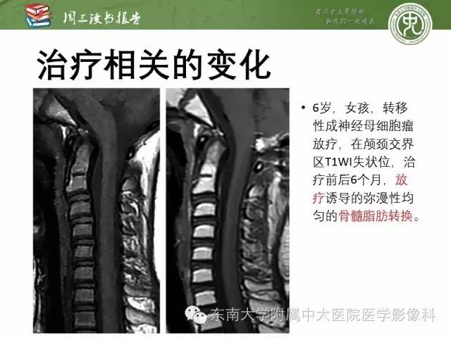 【PPT】儿童骨髓MRI表现