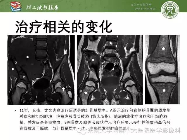 【PPT】儿童骨髓MRI表现