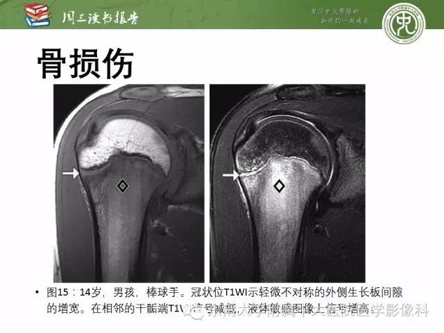 【PPT】儿童骨髓MRI表现
