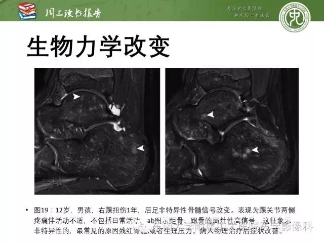【PPT】儿童骨髓MRI表现