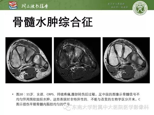 【PPT】儿童骨髓MRI表现