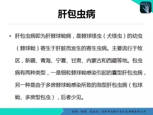 【PPT】肝包虫病