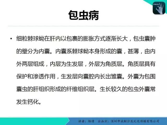 【PPT】肝包虫病