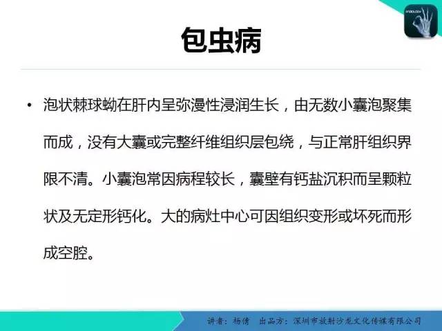 【PPT】肝包虫病