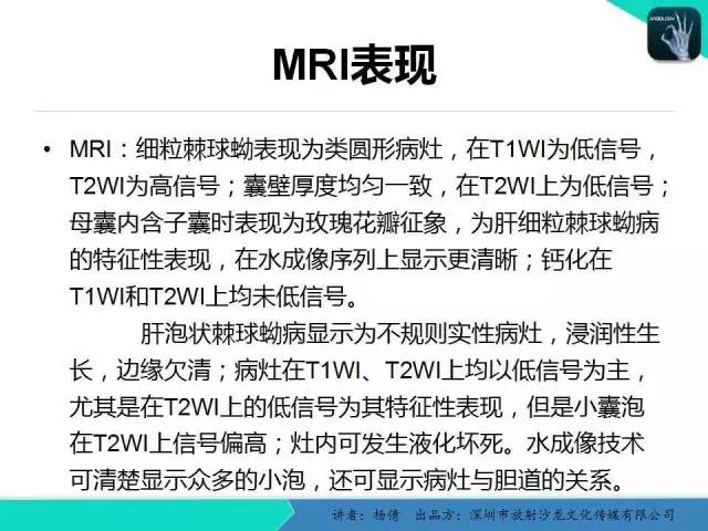 【PPT】肝包虫病