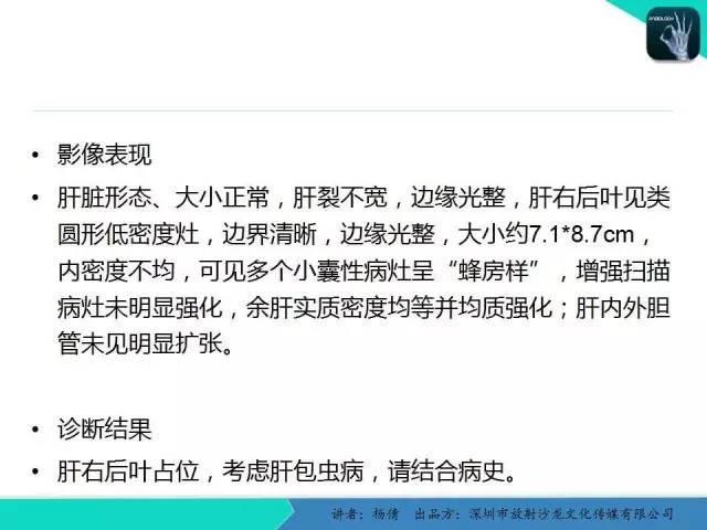 【PPT】肝包虫病